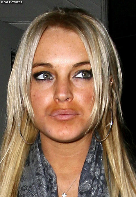The epidemic of spray-tanned, tanned ginger person. The epidemic of spray-tanned,