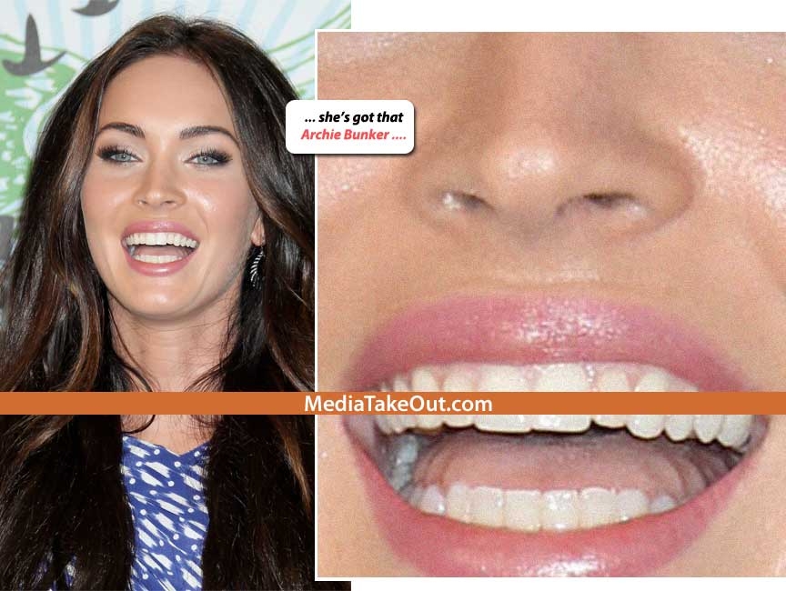 megan fox plastic surgery nightmare. megan fox plastic surgery