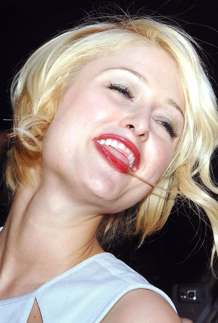 Teeth of Lindsay Lohan
