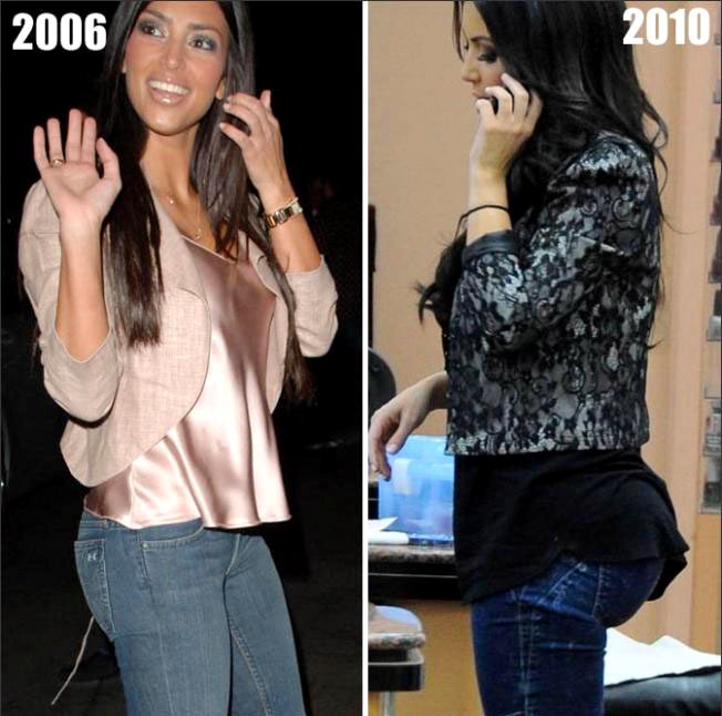 Kim Kardashian Butt Before And After 45