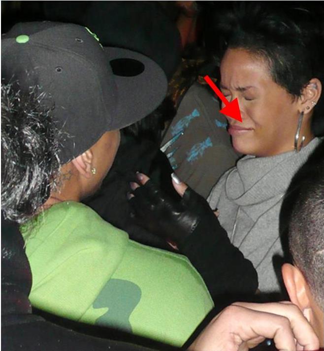 Rihanna gave Chris Brown HERPES, that's why he snapped. How would've you reacted?