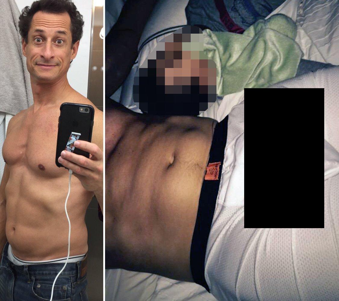 Anthony weiner dick nude